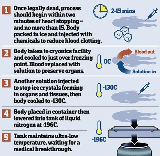 全世界约有350人死后冷冻保存，十年内可能解冻复活