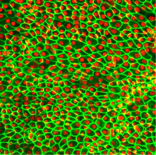 科学家开发干细胞视网膜贴片 可治疗退化型失明