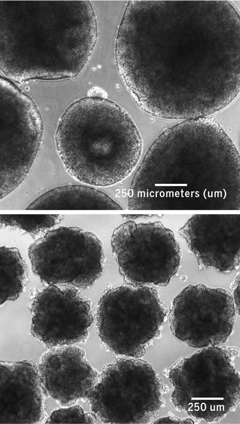 科学家们正在实验室中培养尼安德特人的迷你大脑