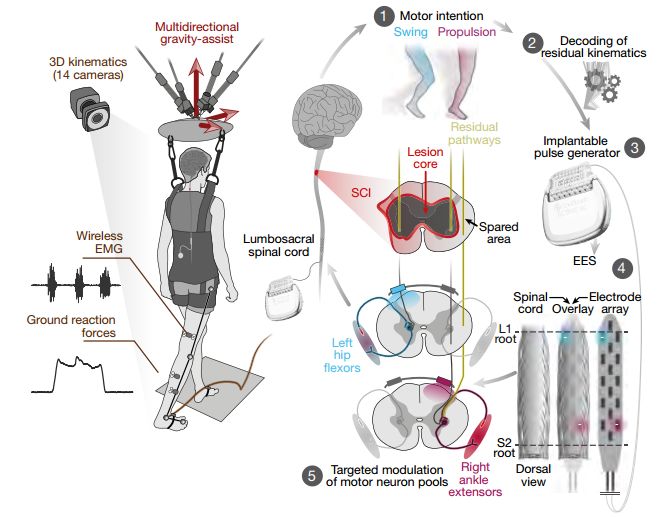 今日《自然》重磅：不可思议 三名瘫痪患者重拾行走能力