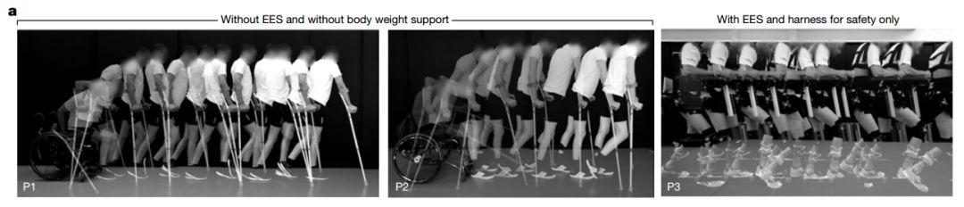 今日《自然》重磅：不可思议 三名瘫痪患者重拾行走能力