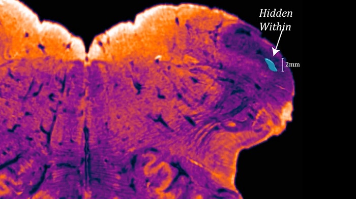 科学家发现人类大脑中的一个新区域 拥有独特功能