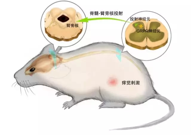 研究发现控制痒的神经元 挠不挠它说了算