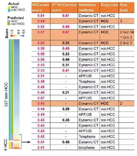 中国科学家开发筛查新技术 实现肝癌早发现早治疗