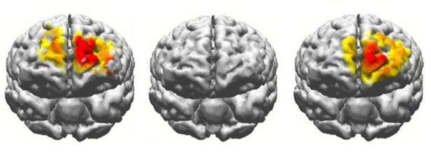 科学家发现一种修复大脑受损通路并恢复记忆功能的非侵入性方法