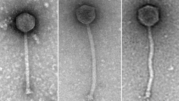 世界首例 科学家使用转基因病毒来治疗抗生素耐药性细菌感染