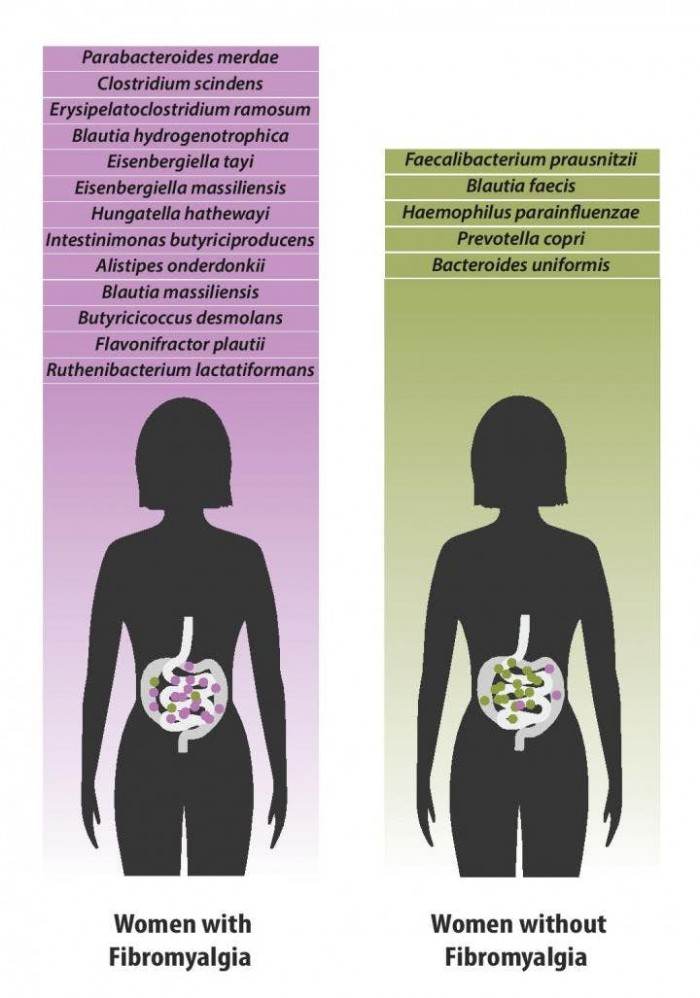 研究首次发现纤维肌痛症跟肠道微生物变化有关