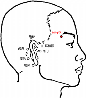 艾灸不能乱灸 艾灸禁灸穴，可千万不要出错！