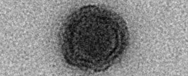 未知基因组的神秘“巨型病毒”揭示病毒世界变异性