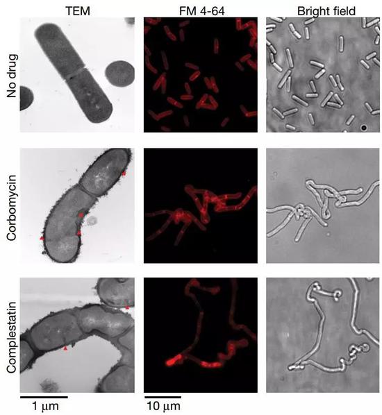 憋死超级细菌 科学家发现与青霉素作用相反抗生素