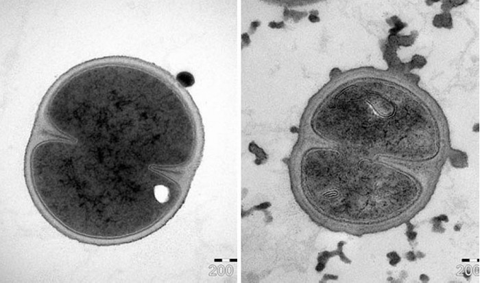 科学家发现新多肽 可在更少剂量下让抗生素效果更明显