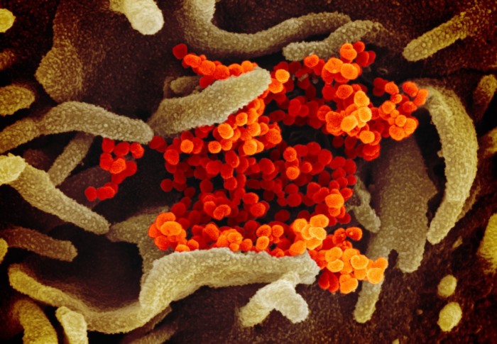 研究称新冠病毒突变可能使其传染性更强