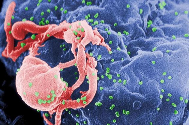 HIV病毒可以藏身大脑中，等待日后感染其它器官