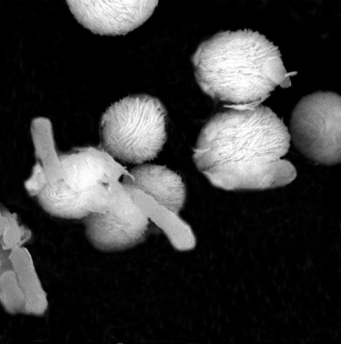 研究发现用石墨烯包裹纳米颗粒可杀死废水中的耐药菌