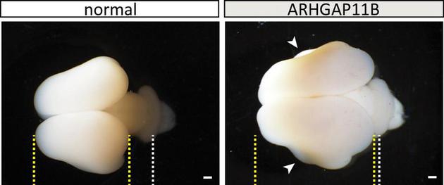 “人猿星球”或将成现实？人类基因植入猴脑后变得更强大