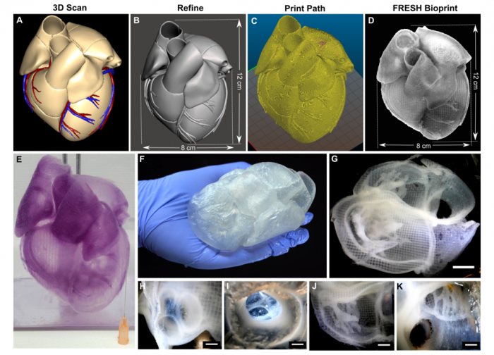 卡内基梅隆大学的3D生物打印心脏为外科医生提供了新工具