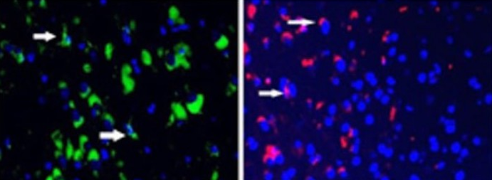 科学家利用再生药物“召唤”干细胞至所需位置 以提高疗效