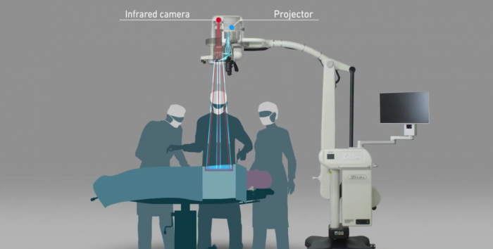 松下相机将实时图像投射到手术中的患者身上