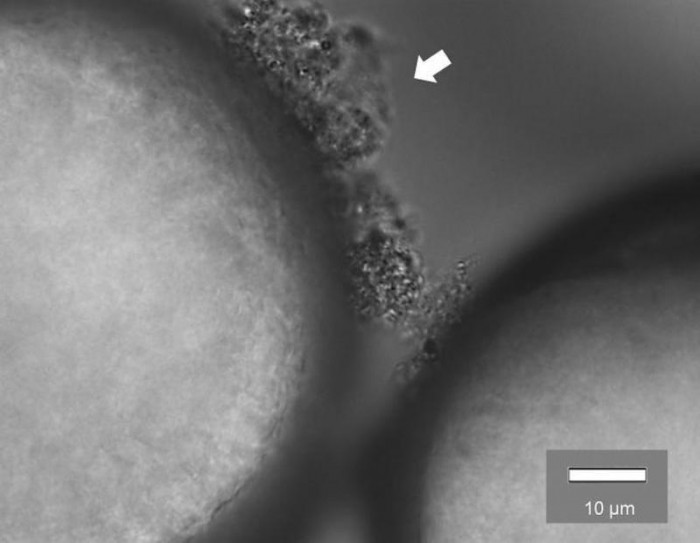 研究发现废水中的微塑料帮助超级细菌“分享危险基因”