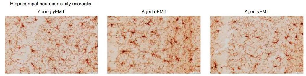移植粪便里的菌群 能让衰老的大脑重返青春？