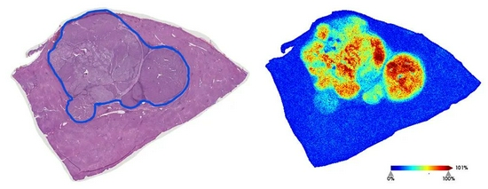 验血就能检测早期肝癌？科学家们找到新希望