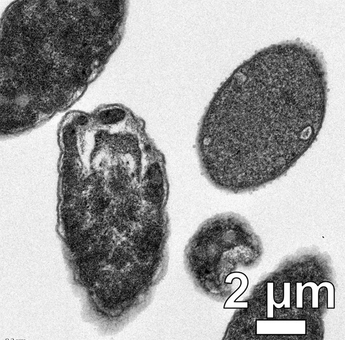 “分子机器”：科学家开发能有效杀死细菌的新纳米级“钻头”